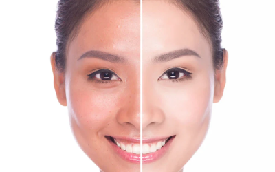 راهنمای انتخاب بهترین محصول سفید کننده پوست صورت و بدن