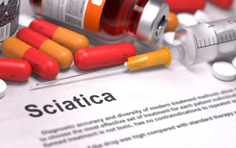 مسکن قوی برای تسکین درد سیاتیک