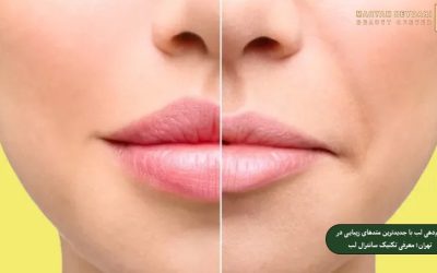 فرم‌دهی لب با جدیدترین متدهای زیبایی در تهران؛ معرفی تکنیک سانترال لب