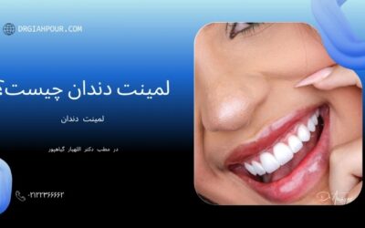 راز لبخند هالیوودی؛ هر آنچه باید درباره لمینت دندان بدانید