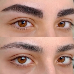 اجرای حرفه‌ای میکروبلیدینگ در مرکز تخصصی شبنم راد